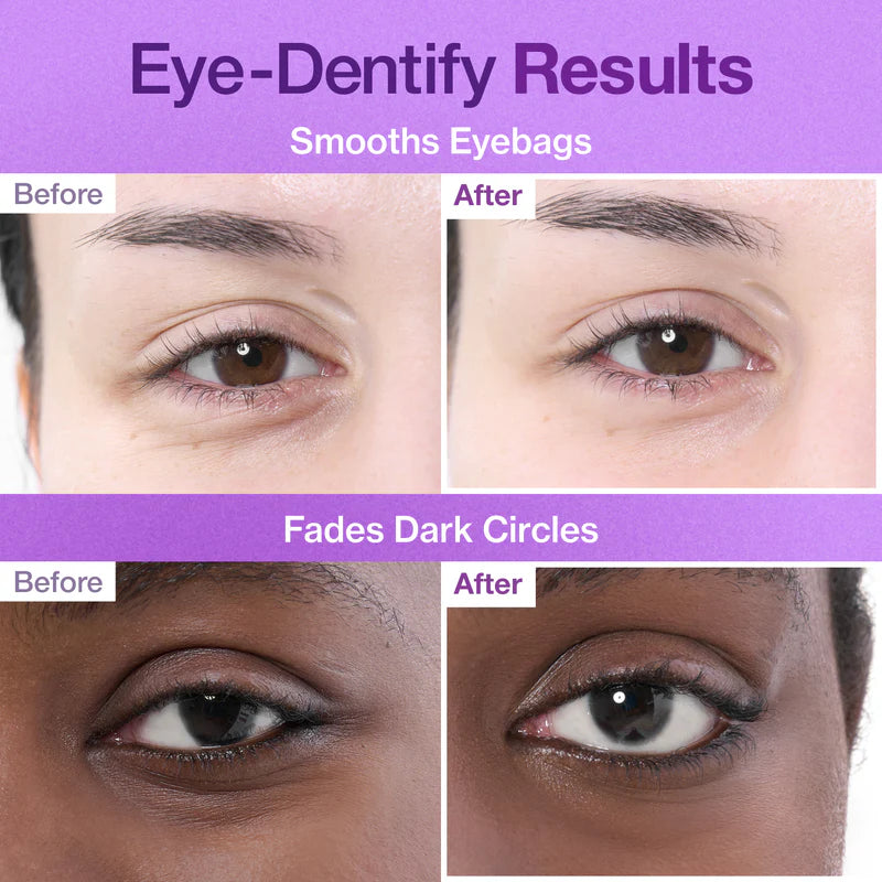 No.9 NAD Collagen Under Eye Patches (5ea)