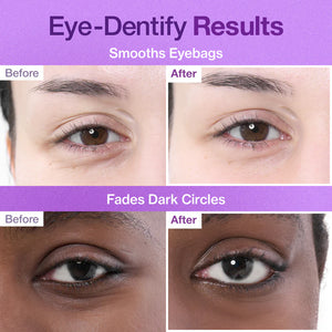 No.9 NAD Collagen Under Eye Patches (5ea)