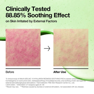 ANUA - Azelaic 10 Hyaluron Redness Soothing Pad