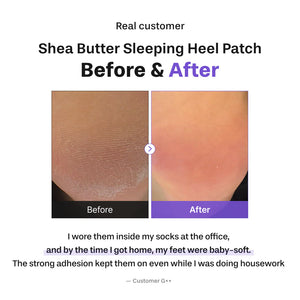 Shea Butter Sleeping Heel Patch 10pcs