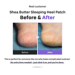 Shea Butter Sleeping Heel Patch 10pcs