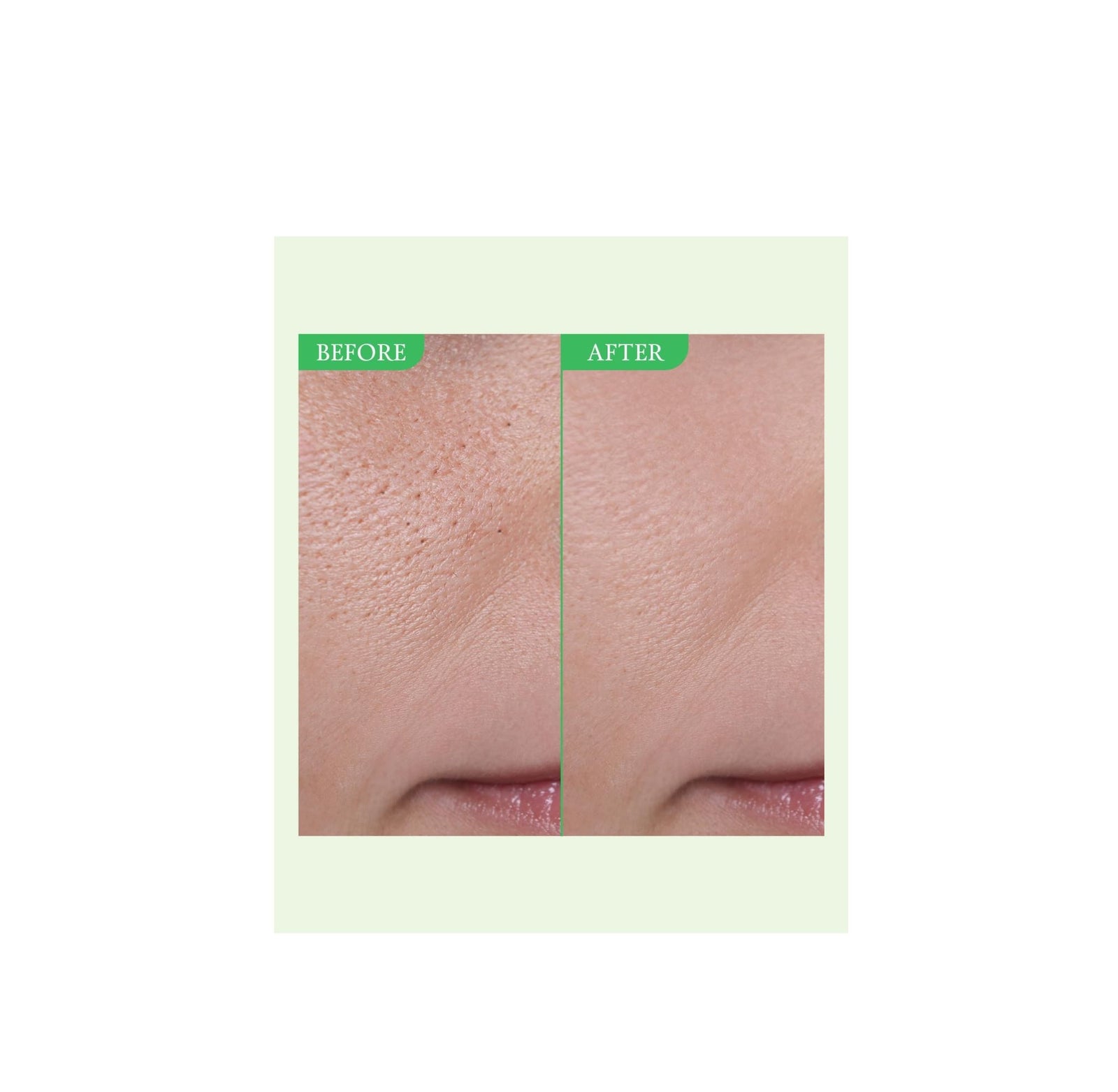 FULLY - Green Tomato Serum