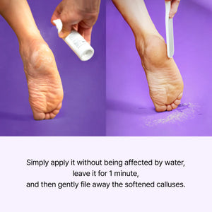 Callus Remover Peeling Foot Spray 100ml