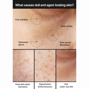 celimax - Pore+Dark Spot Brightening Cream