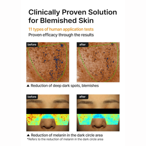 celimax - Pore+Dark Spot Brightening Cream