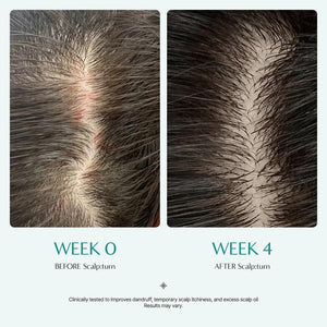 lilyeve Scalp Turn Cica PDRN Brush Ampoule