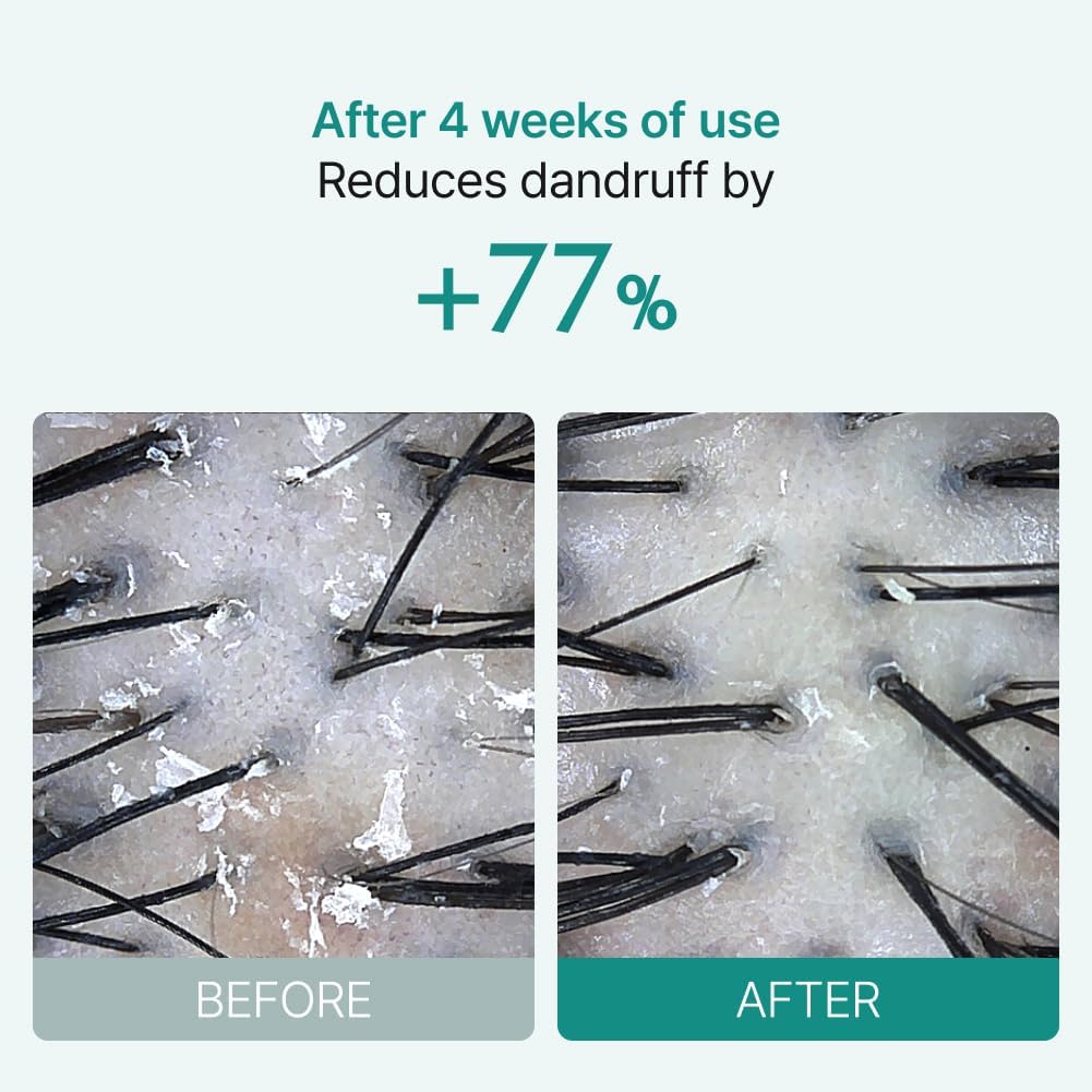 lilyeve Scalp Turn Cica PDRN Brush Ampoule