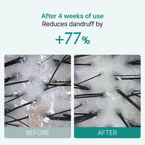 lilyeve Scalp Turn Cica PDRN Brush Ampoule