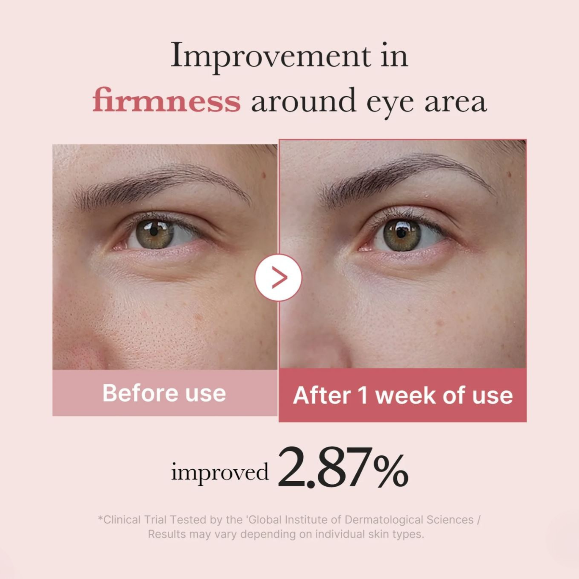 medicube - PDRN Pink Peptide Eye Cream