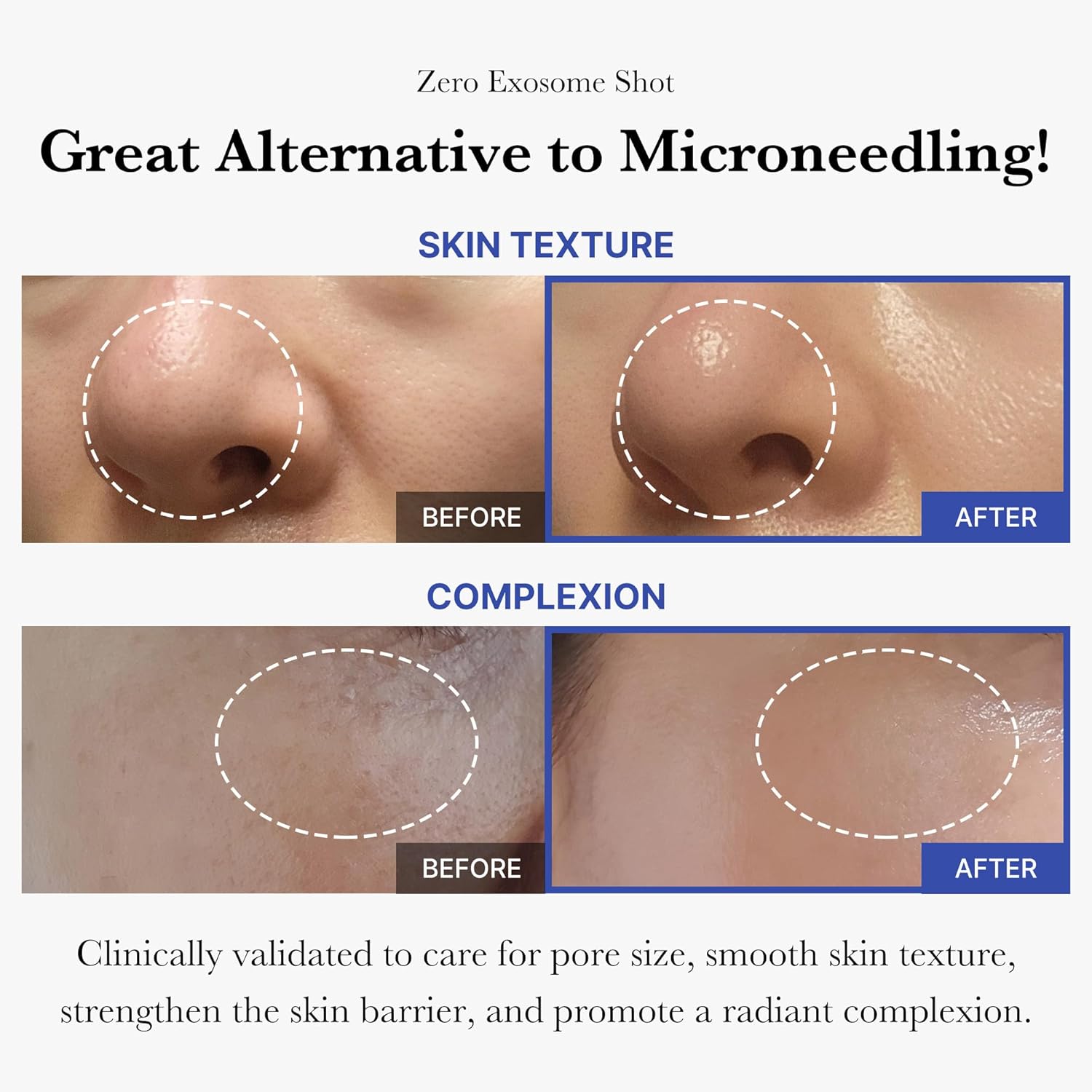 medicube Zero Exosome Shot 7,500 PPM