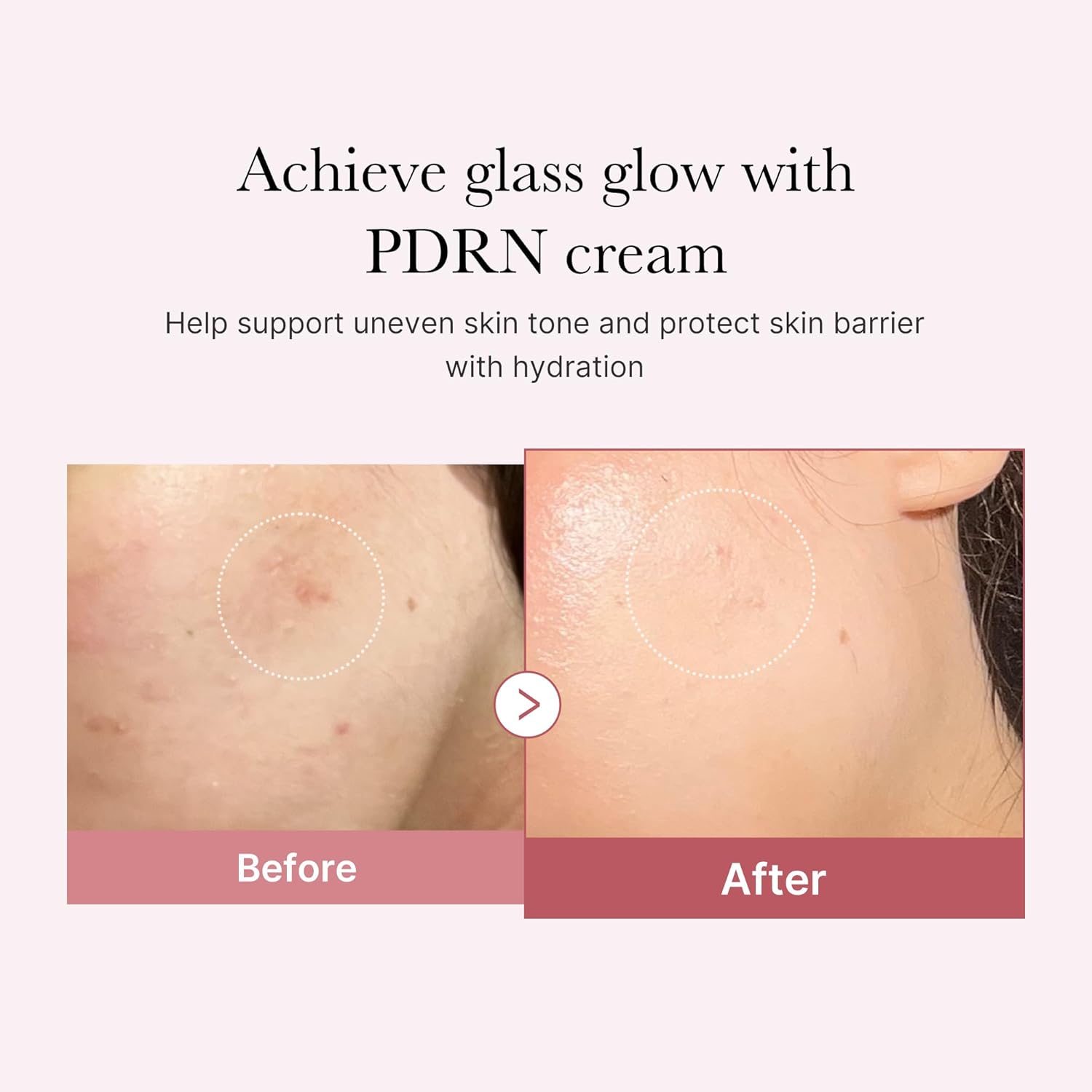 medicube - PDRN Pink Hyaluronic Moisturizing Cream